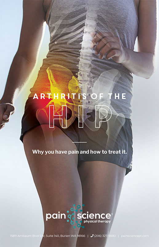 Arthritis of the Hips Free eBook Cover